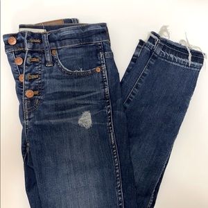 Madewell Distressed and button up Jeans